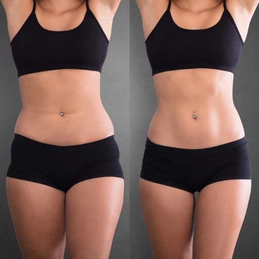 before and after spa 6