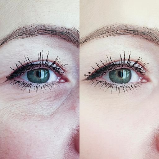 before and after spa 5